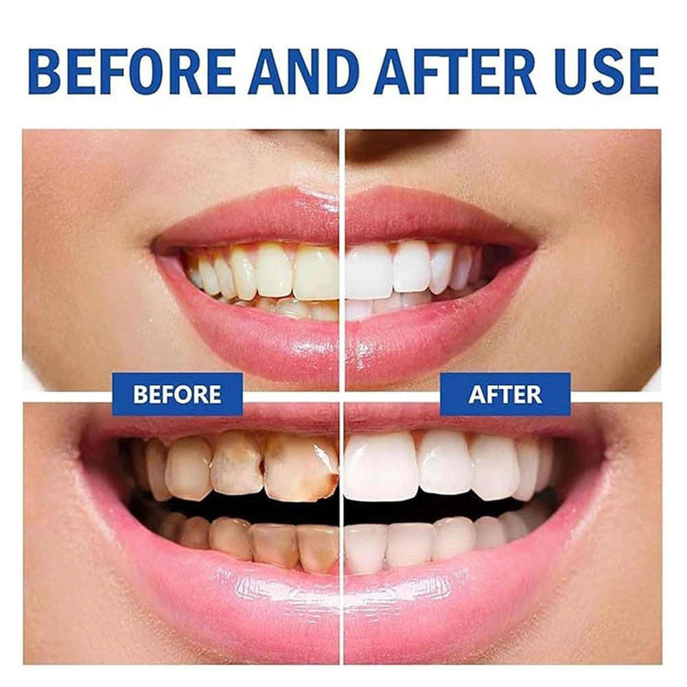 120g Hydroxyapatite Toothpaste,Gentle Mint,Breath Refreshing Whitening Toothpaste,Intensives Stain Removal Tooth Paste,Oral Care