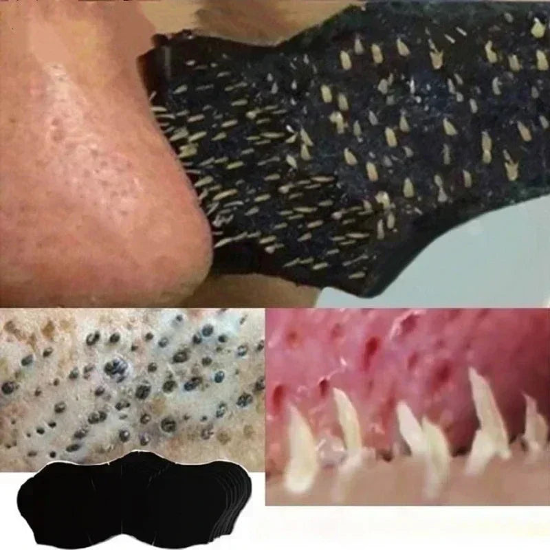 100/50PCS Unisex Blackhead Remove Mask Nasal Strips Shrink Cleansing Pore Nose Black Head Remove Stickers Skin Care Mask Patch